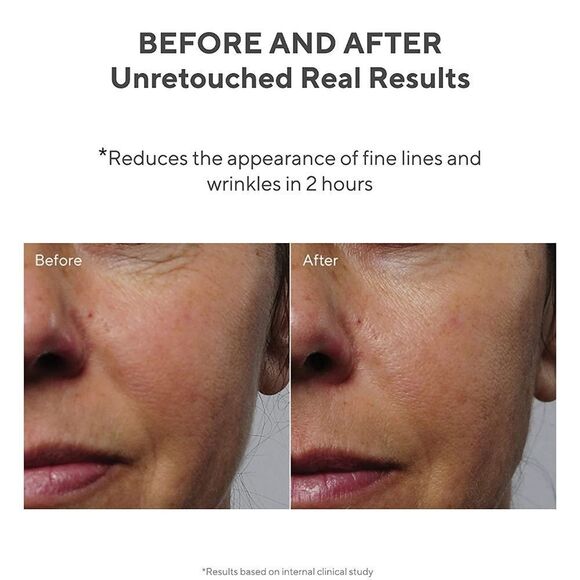 Murad Resurgence Retinol Youth Renewal Eye Serum - Picture 7 of 14